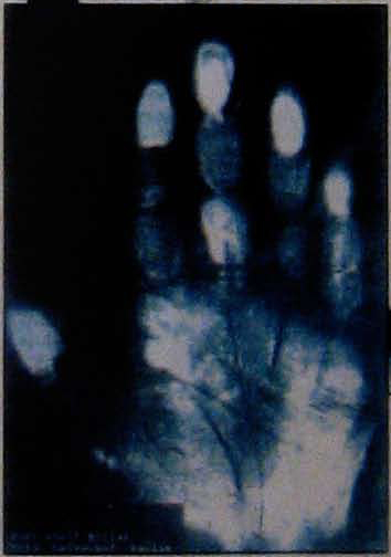 IV - The Hand of Hitler Hitler14