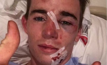 Le jockey Chris Meehan écrasé par une ambulance - 5/07/16 D7e9c110