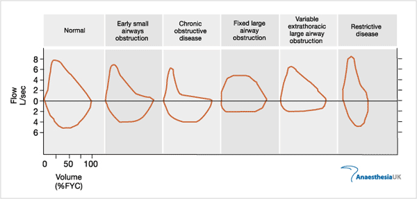 Tests of pulmonary function Flow_v10