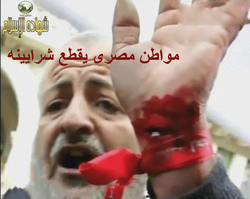 صور مظاهرات 25 يناير: مواطن مصرى يقطع شريانه Mozahr11