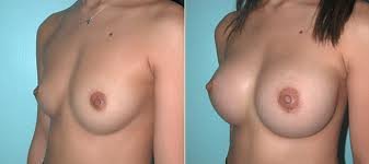 I have FOUND them!!!!!!!! Boobs111