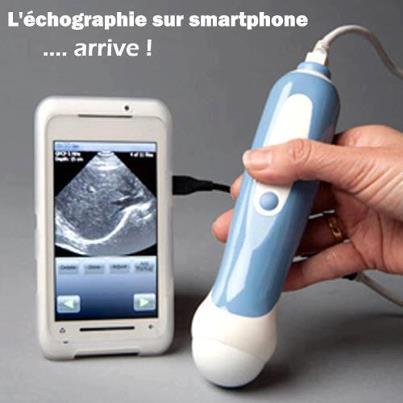 l'echographie sur smartphone!! 55635810