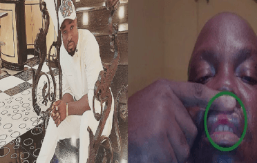 Harrysong Vs Five Star Music: Kcee’s Manager Beats Harrysong’s Manager To Pulp In Public (See Photos) Kcees-10