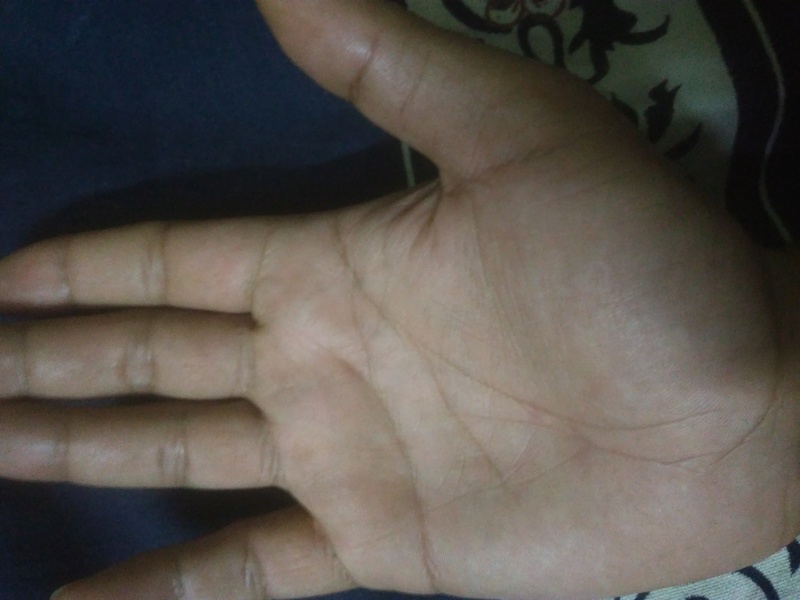 Can you see any career prospects in my palm? Or anything different? 14820813