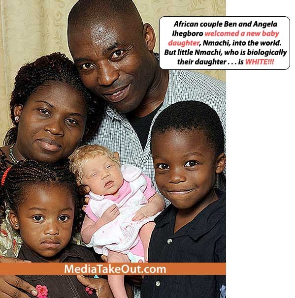 Blonde Bombshell: Black Couple's White Baby White_10