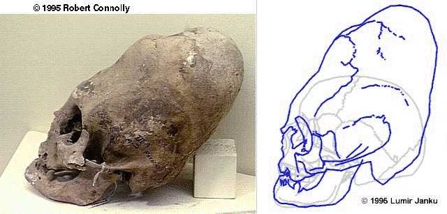Crânes étranges, une tradition pour ressembler aux Dieux et/ou crânes d'aliens? (photos authentique) Conehd10