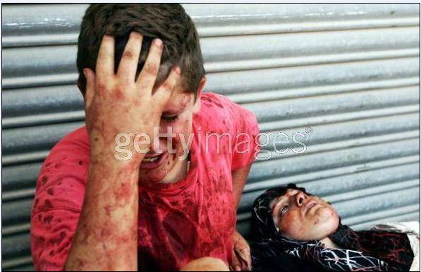 Last Moments of A Dying Mother and Her Child ....in Palestin 410