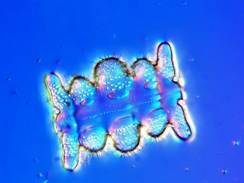 Microscopie 2015 Mcaptu11