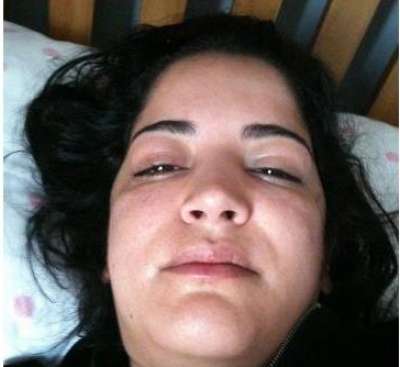 دواء خاطئ يشوه وجه ممثلة الإغراء المغربية سناء موزيان بالصور 39098216
