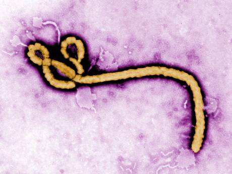 EBOLA:  VIRUS MAY HAVE BECOME MORE CONTAGIOUS AFTER MUTATING SINCE START OF OURBREAK, SCIENTISTS WARN Ebola-10