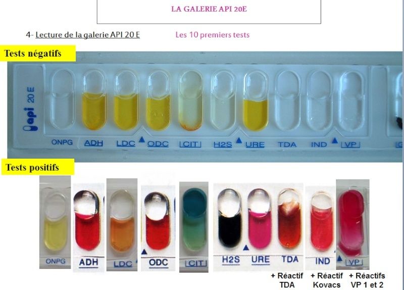 TD 5 de Microbiologie Oran IGMO : Les tests biochimiques d’identification 113