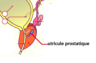 simptome de prostatita parenchimatosa prostatita cronică sânge în urină