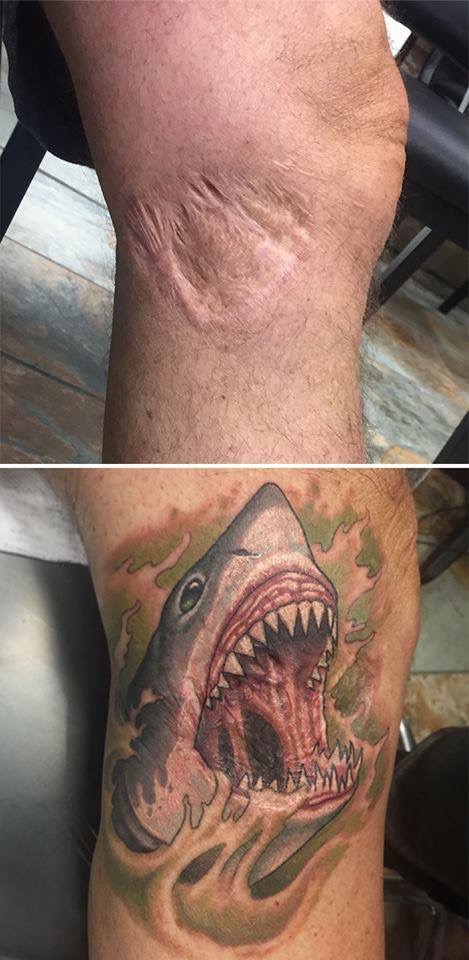Turning scars into tattoos... 89d08110
