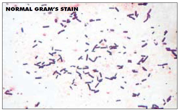 la coloration de Gram Gram_n10