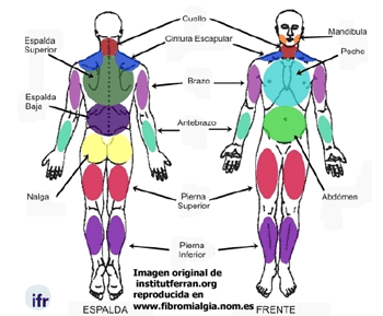  Nuevos criterios para el diagnostico de la Fibromialgia; Areas-10