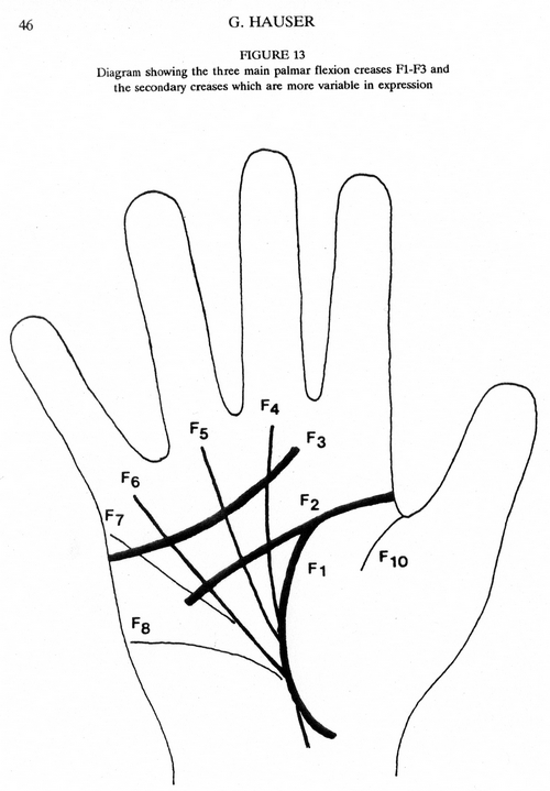 Any Body Can Give Any Answer For This (length life line) - Page 3 Hauser10