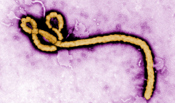 MISSOURI DOCTOR:  "IT'S JUST A MATTER OF TIME BEFORE EBOLA IS CARRIED TO EVERY CORNER OF THE WORLD" 45321010