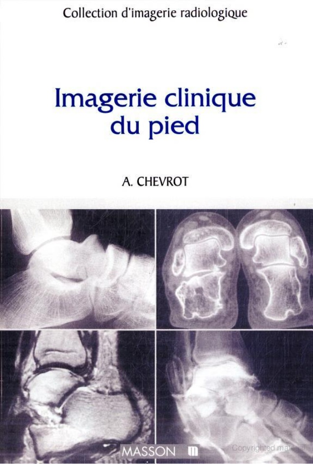 Imagerie clinique du pied (Masson) Slide-84