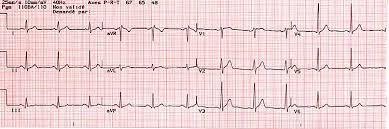 VOS AVIS ,BALADE A 105 7EME EDITION DU 14 AU 16/8/2015 Ecg10