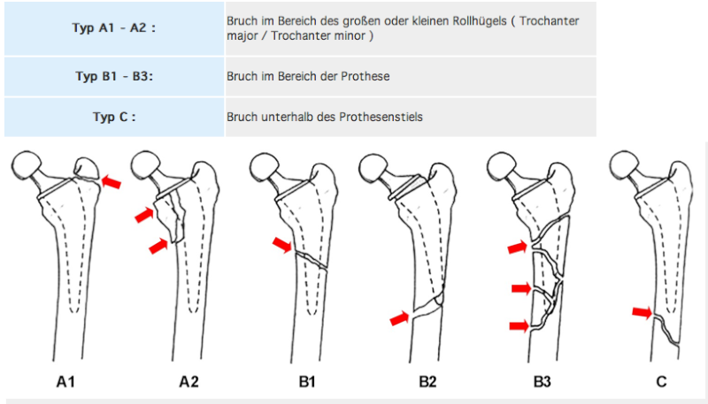 Musterfrage 1
