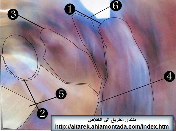 معجزة بالصور للراهب أنجيلوس الأنطونى من دير مارمينا العجايبي بتاريخ 27 - 8 - 2006 288gf310