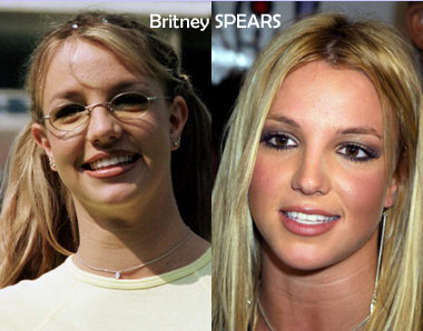 britney spears avant aprs Avant_10