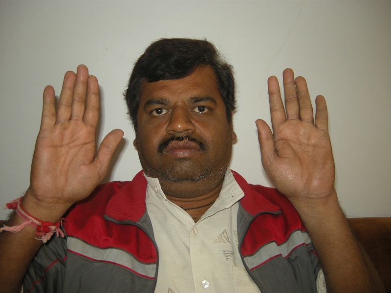What is a signification if the man is having different type of hands? Dscn9010