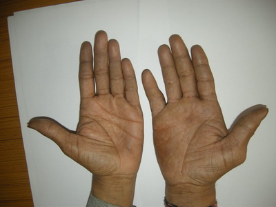 What is a signification if the man is having different type of hands?  Palmwe10