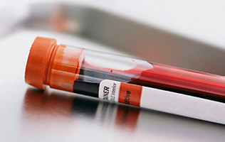Blood test accurately distinguishes depressed patients from healthy controls Fatty_10