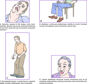 Second-Generation Antipsychotic Drugs and Extrapyramidal Side Effects: A Systematic Review and Meta-analysis  Image_10