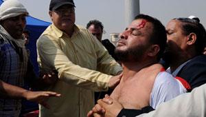 وزارة الصحة: حصيلة الإشتباكات بين مؤيدى مبارك ومعارضيه تصل إلى 34 مصاب 2011-114