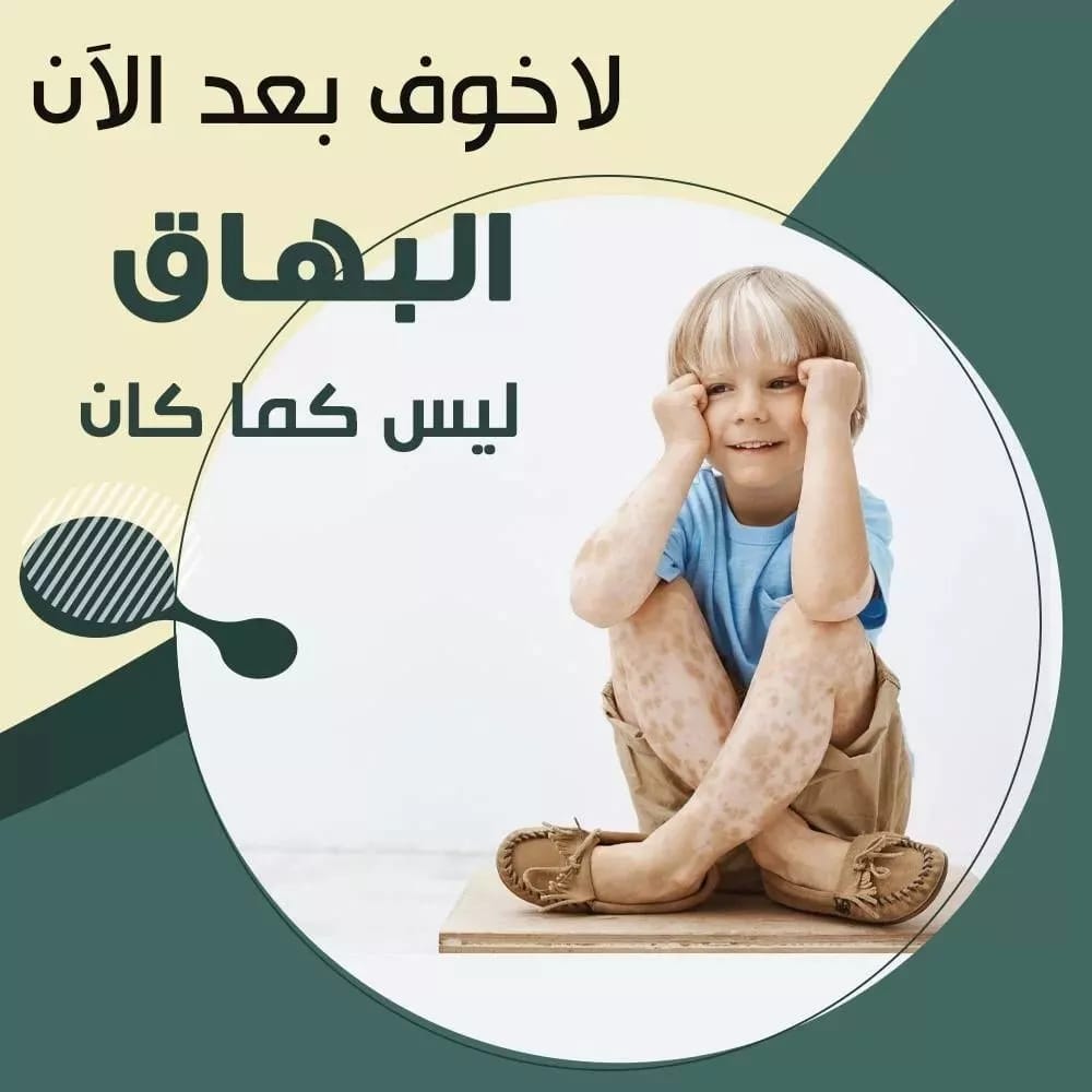 نقص حمض الفوليك | ديما سبا | 0096551189793 Whats141