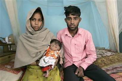Un Bebe Ne Avec Deux Tetes Un Bebe Ne Avec Deux Tetes