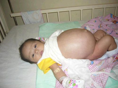 Bayi dalam perut bayi Yl4yy410