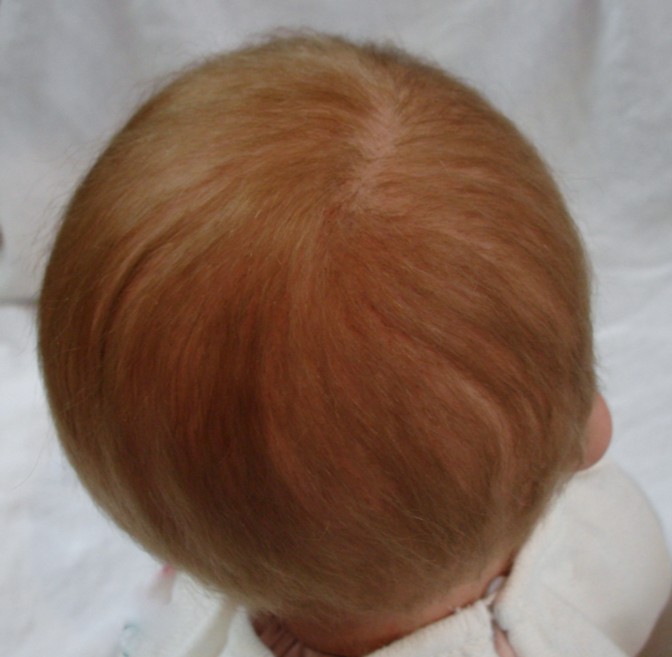 Naked Baby Contest  - Rooted Hair 00810