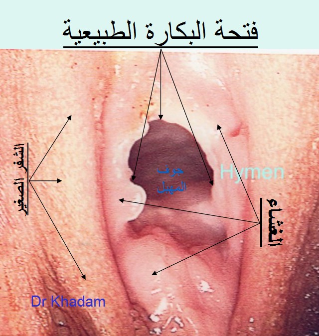 فضيحة شرموطة السيريا روم "بسمة" الملقبة بـ " مهبولة خانوم" 46603310