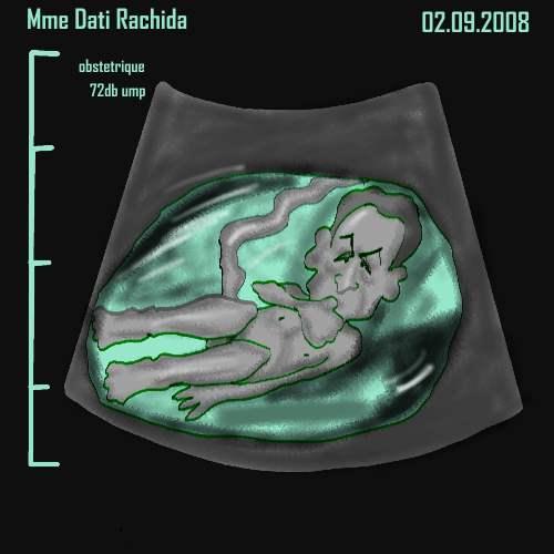 Rachida DAti enceinte : la preuve ! Echogr10
