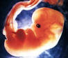 * مراحل نمو الجنين (الأسبوع العاشر) Fetald17