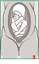 رحلة الحمل والولادة عند الإنسان "الفصل السابع : أوضاع الجنين عند الولادة " Footli10
