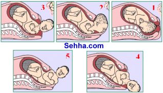 رحلة الحمل والولادة عند الإنسان "الفصل الخامس : مراحل الولادة الطبيعية " Stage211