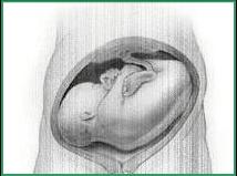 رحلة الحمل والولادة عند الإنسان "الفصل السابع : أوضاع الجنين عند الولادة " Transv11
