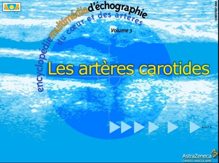 Cardiologie Encyclopedie vol3 - Echographie des artres carotides 90732710
