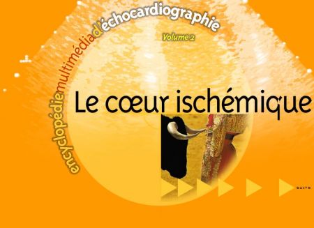 Cardiologie Encyclopedie Vol 2 Echographie du coeur ischemique Vol2ca10
