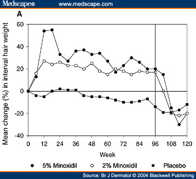 minoxidil - RejuvePlex and minoxidil -- Replace?  or use both?? Bjd47010