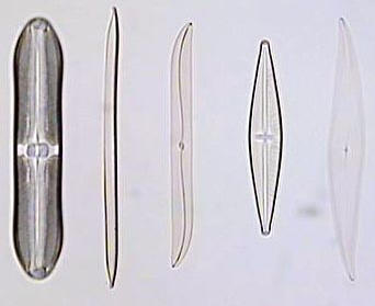 الطحالب الدياتومية Diatoms  Diatom10