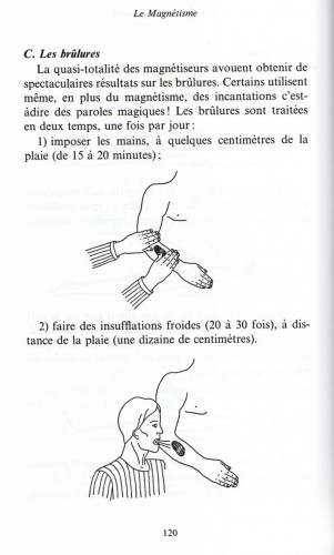 Le magnétisme. (brûlure) 410