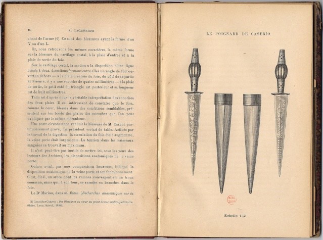 Alexandre Lacassagne Coutea17