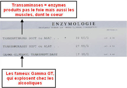 Gamma GT, transaminases : pour vérifier l'état de votre foie Gama10