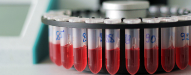 Des chercheurs belges élaborent un vaccin thérapeutique contre le VIH Sida1810