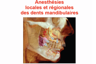 Anesthésies locales et régionales des dents mandibulaires 476_5410